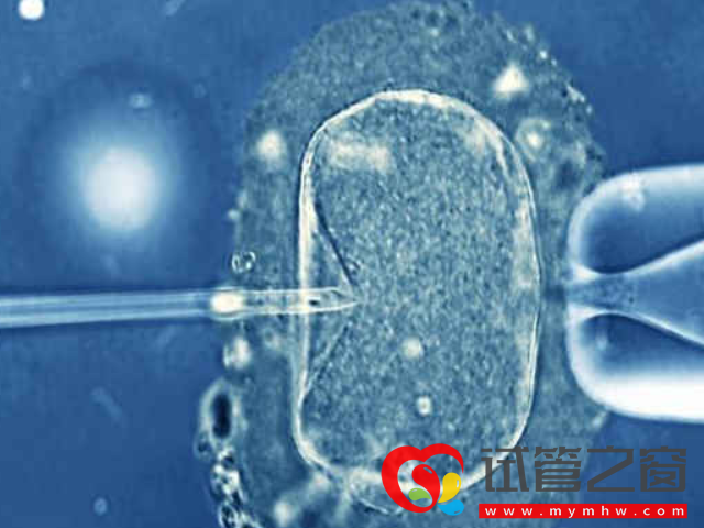 国内三代试管指定胚胎性别有要求,这几类夫妻放心选男孩(图3) 三代试管适合遗传病