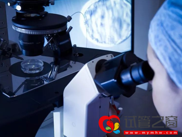 国内已婚女性冻卵前期准备须知,不满足条件就不要想了(图3) 取卵手术大概15至20分钟