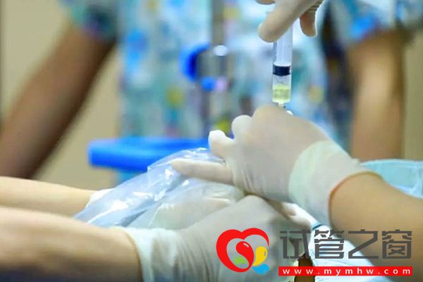 8号染色体短臂缺失24mb后果严重,羊穿结果异常生唐氏儿(图1) 8号染色体短臂缺失后果严重