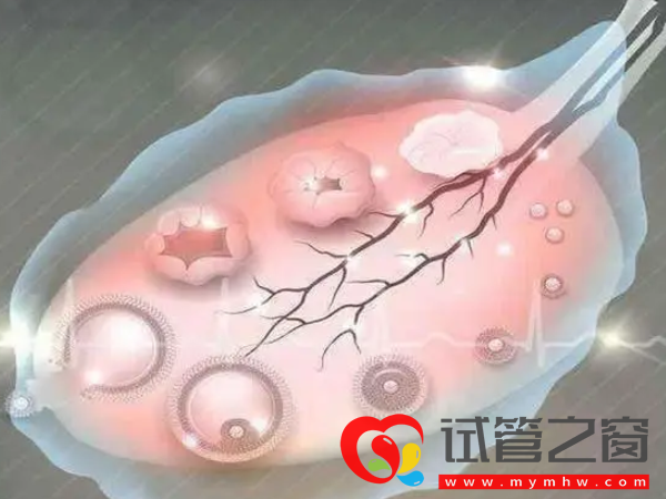 B超查空卵泡准确率并不高!如何能查出方法有三种(图2) 空跑卵取出卵子可查出