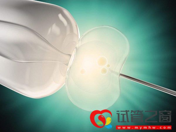 防止试管婴儿出现空卵泡讲方法,找准原因才好解决(图3) 趁年龄小做试管可预防空卵泡