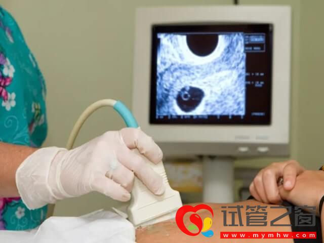 移植第十天突然就没任何早孕感觉是生化了吗?(图1) 移植10天早孕消失是生化