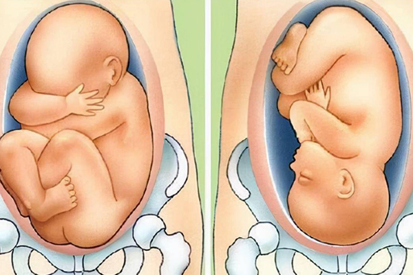 胎位看生男生女方法解析,loa和roa哪个怀男孩概率大快来瞧!(图2) 胎儿头位可能是男宝