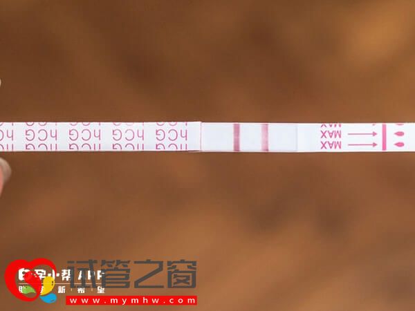 囊胚移植后老打嗝容易影响生活,这3个方法学起来(图1) 试管移植后老打嗝怎么回事