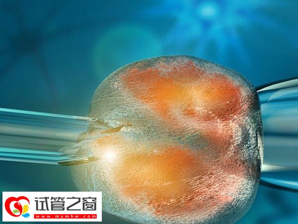 无麻药取卵亲身经历分享,全程十几分钟痛感并不明显(图1) 不打麻药取卵会不会很难受