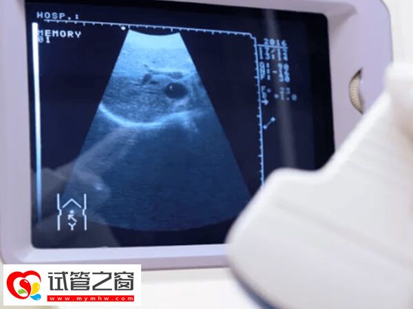 试管婴儿查体到移植至少2个月,期间做好这些更容易成功(图2) 试管婴儿操作过程