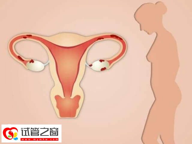 影响子宫内膜容受性的因素有哪些(图1) 111.jpg