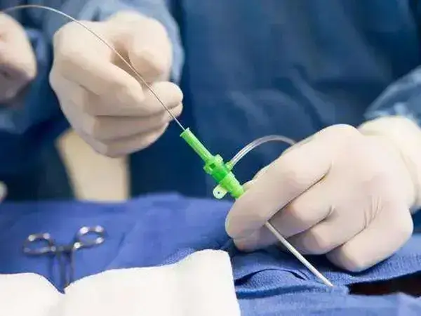 试管婴儿可采用腹部取卵的6类人群罗列,成功率较为可观!(图1) 试管哪些人可做腹部取卵