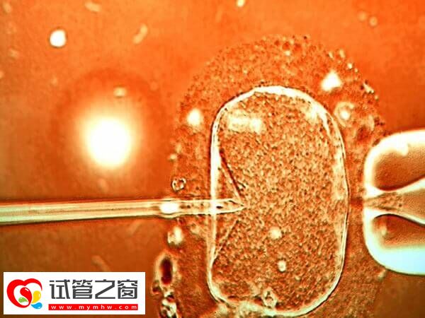 试管婴儿成功率与助孕代数有无关系?看其影响因素方知(图1) 试管婴儿成功率与什么有关