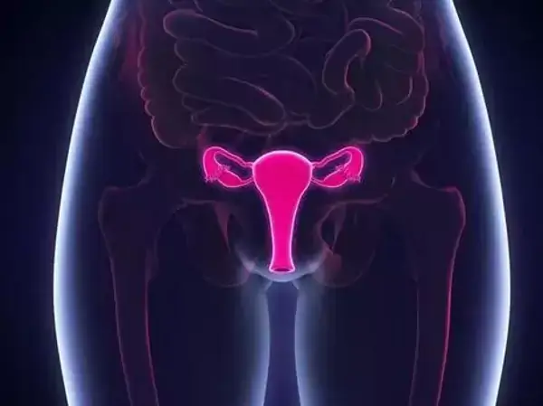 会引起不孕的子宫疾病有哪些(图1) 子宫畸形则是指子宫形态不规则