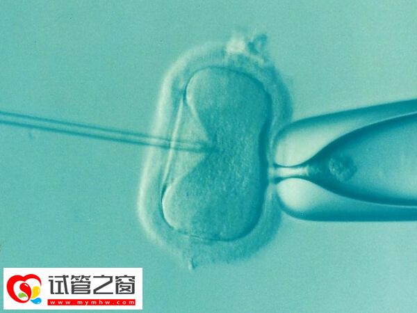 试管婴儿移植后胚胎发育慢的原因是什么(图1) 导致胚胎的发育慢的因素有很多