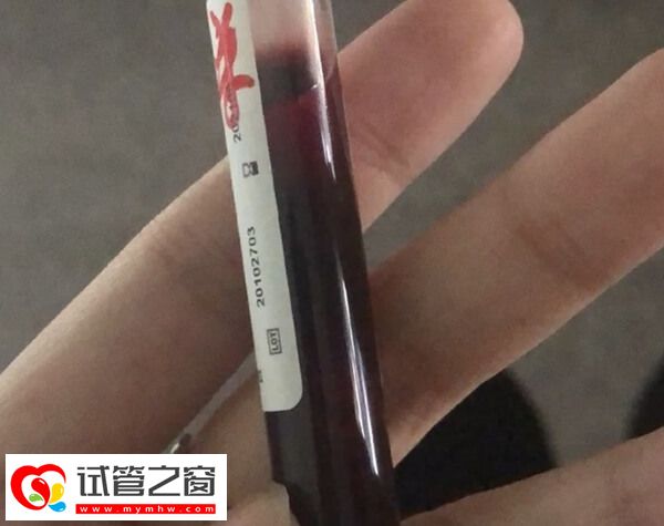 女方有糖尿病可不可以做试管婴儿(图1) 做试管期间要控制好血糖
