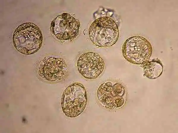 试管婴儿移植后呕吐的原因是什么(图1) 移植后要避免吃辛辣食物