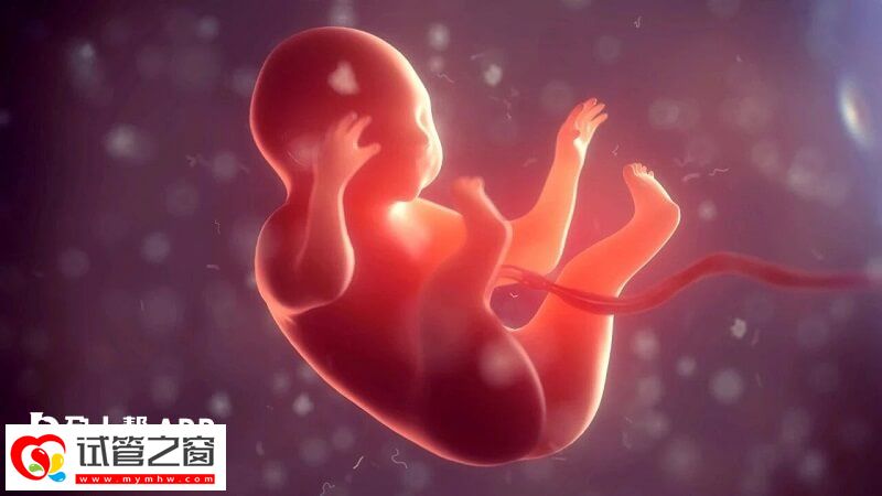 羊水浑浊是什么原因造成的(图1) 羊水浑浊可以通过物理治疗改善