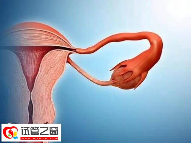 子宫偏小对试管婴儿的影响有哪些(图1) 子宫偏小会导致内膜容受性差