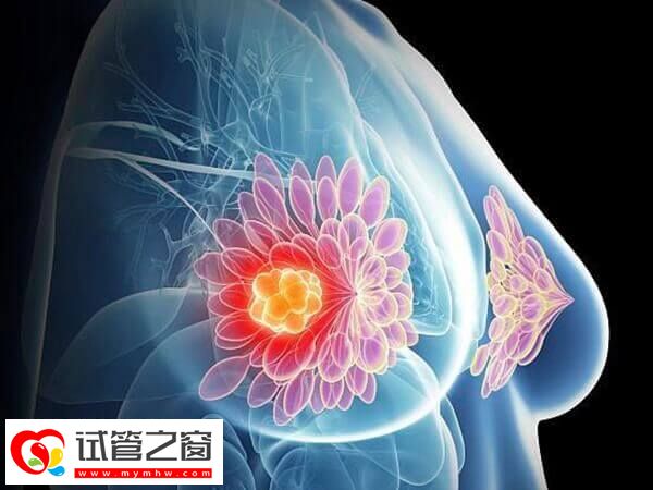 移植后乳房越来越软的原因是什么(图1) 怀孕后乳房变软是正常生理现象