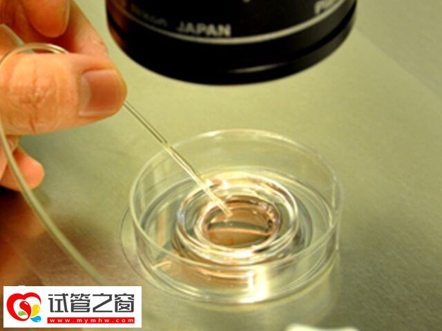 国内供精试管要多少钱(图2) 供精和卵试管流程相差不大