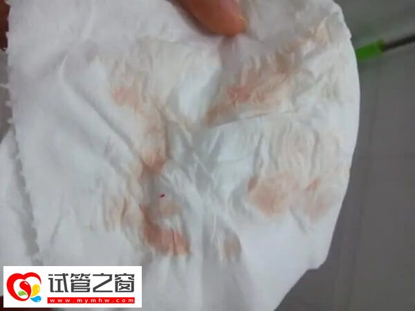 移植两个鲜胚可能会有出血现象,或与内膜受刺激有关(图2) 移植初期出血正不正常