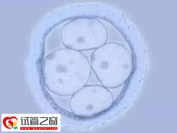 胚胎移植后宫缩是什么感觉(图1) 胚胎移植后要注意调整自己的心情