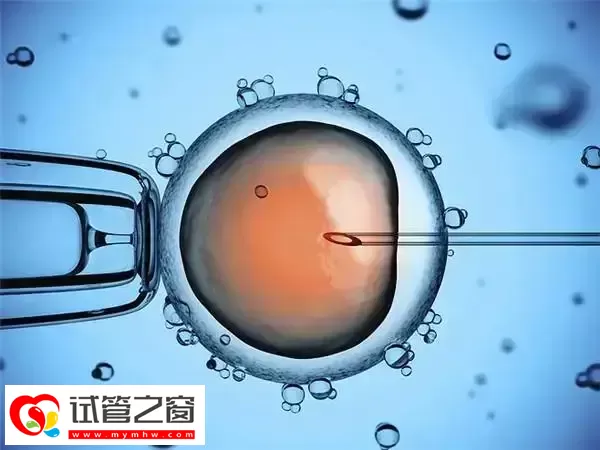 凯里试管婴儿费用多少(图2) 一代试管婴儿费用约3万元