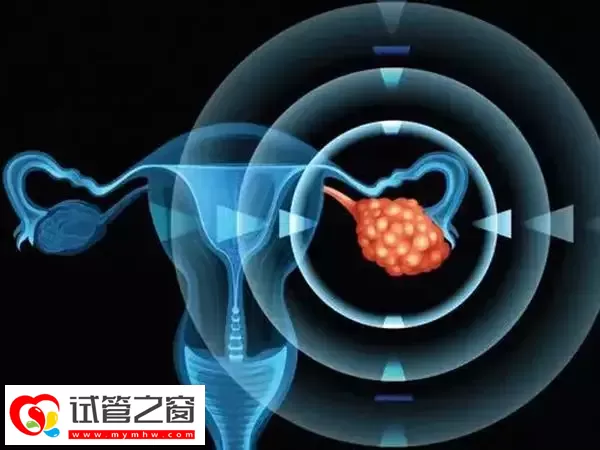 多次促排卵对卵巢的影响有哪些(图1) 连续促排要注意停止休息