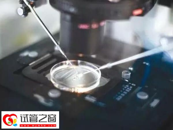 涿州市医院试管成功率多少