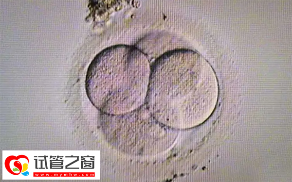 试管婴儿三代筛查过程是怎样的(图1) 胚胎PGD筛查一般不需要抽血