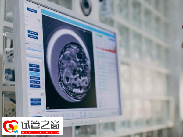 试管婴儿三代筛查过程是怎样的(图3) 三代试管能阻断单基因遗传病
