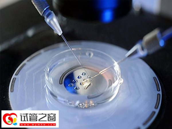 三代试管pgs筛查是什么意思(图1) pgs筛查从技术上看可以选看性别