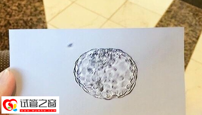 试管三代胚胎筛查结果咋看(图3) 结果单显示NAD就说明胚胎正常