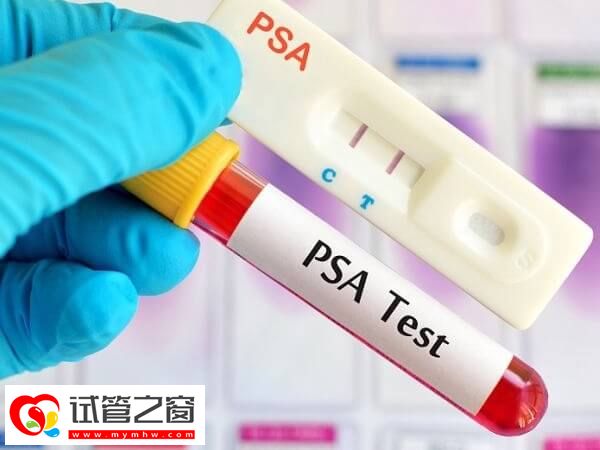 试管拮抗剂方案适合什么人群(图1) 高龄女性促排身体负担大