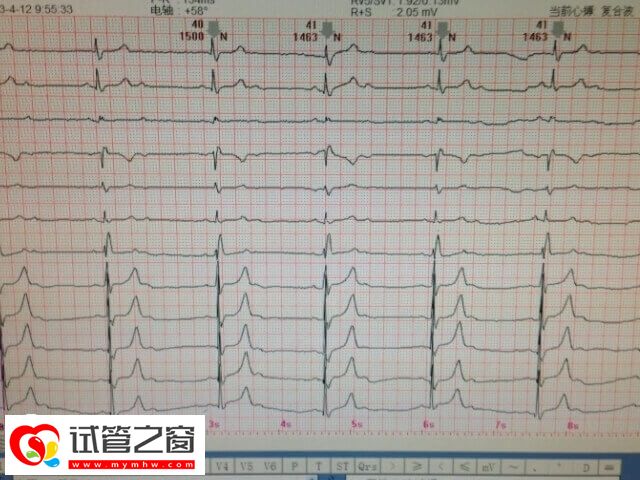 试管移植怀孕后检查要多少钱(图1) 试管移植成功后要做心电图