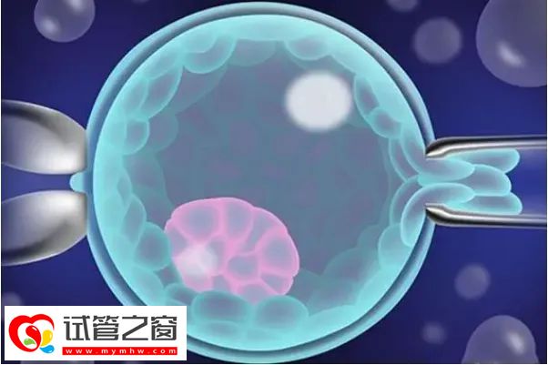 做三代试管婴儿,检测出来是嵌合体,能移植吗?(图1) 什么是嵌合