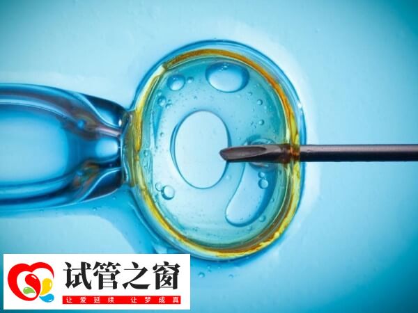 做试管婴儿多久能怀上(图1) 做试管婴儿一个周期需要2到3个月