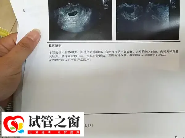 孕酮低于9保胎几率多少(图1) 孕酮低可能会引起胎停