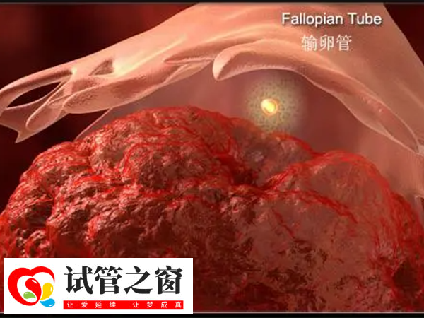 供卵与amh低有无关系(图1) 供卵与AMH低之间存在一定关联