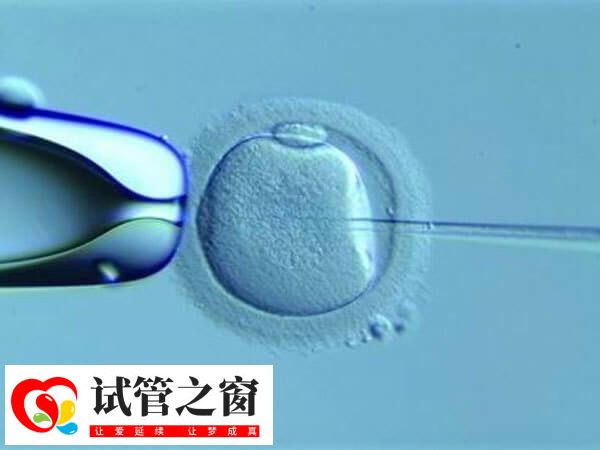 试管婴儿的各种方案有哪些 试管婴儿流程(图1) 试管婴儿选择方案因人而异