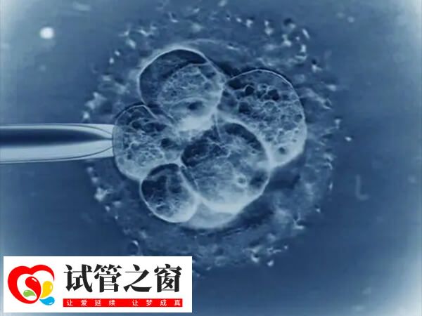 试管婴儿的各种方案有哪些 试管婴儿流程(图2) 试管婴儿短方案用药时间短