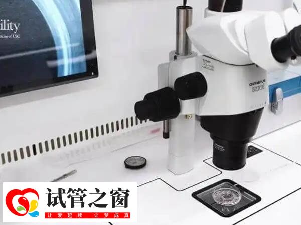 试管多次种植失败怎么办(图1) 试管移植失败先查明原因