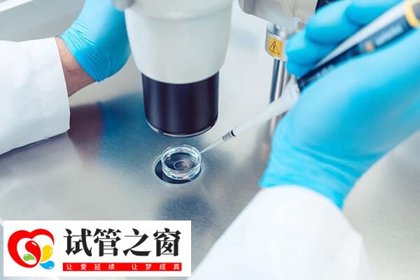 取卵后能不能洗澡洗头(图2) 取卵后要避免性生活