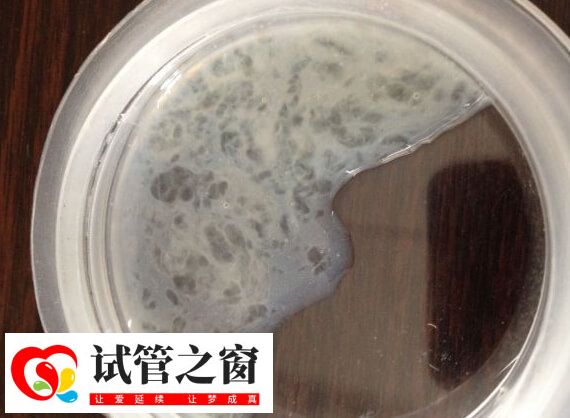 试管婴儿精子的活力分为几个等级(图1) 精子活力三级是精子直线前进