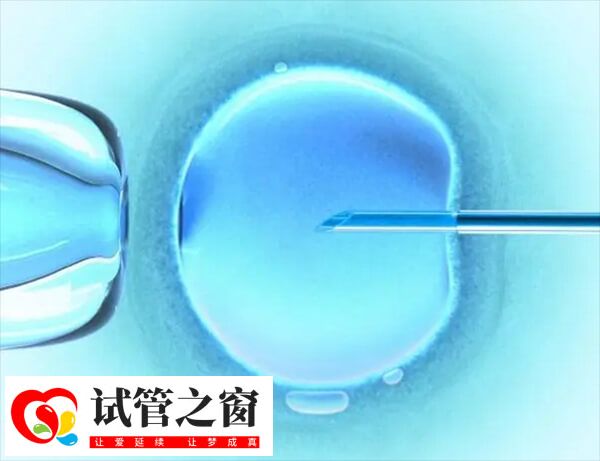 三代试管可不可以单精子注射(图1) 单精子注射是一种显微操作技术