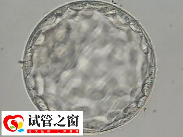 胚胎质量一般是移植还是促排好(图1) 胚胎质量一般也是可以移植的