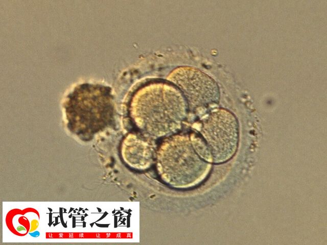 试管婴儿移植哪种胚胎好(图2) 囊胚移植成功率高