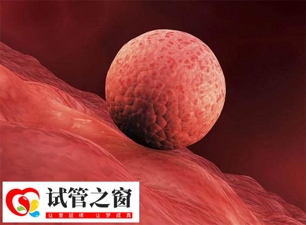 女性内膜线欠清晰是否影响移植成功率(图1) 内膜线欠清可能影响试管移植