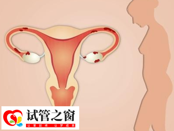 女性内膜线欠清晰是否影响移植成功率(图2) 子宫内膜厚度均匀正常