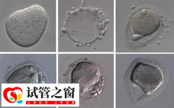 女性内膜13b是否可以移植囊胚胚胎(图3) 13b内膜做试管囊胚移植成功率在20%-30%