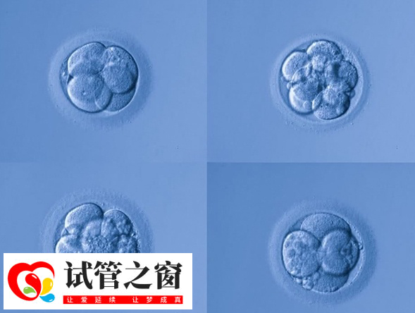 试管婴儿fet移植成功率是多少(图1) fet移植成功率一般在40%-60%左右