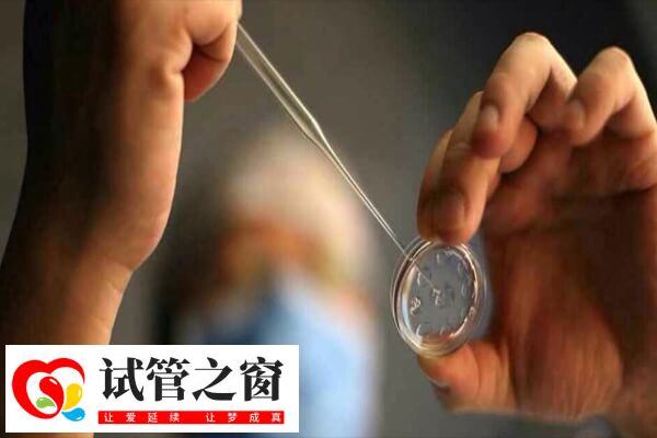 试管前做胸片是查什么(图1) 做试管的目的是获得妊娠并成功生产