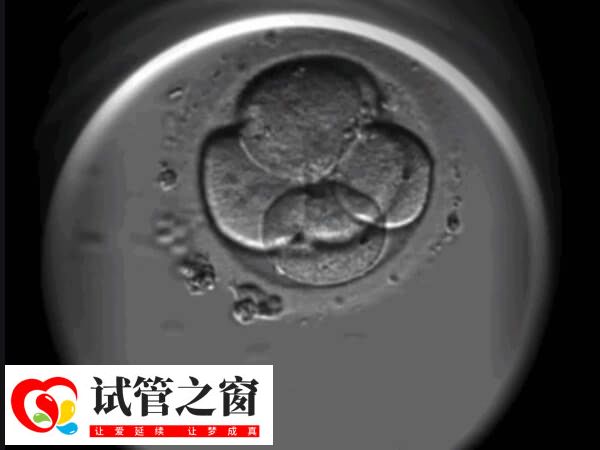 移植3个胚胎成双胎的概率大不大(图2) 影响试管双胎概率的因素多
